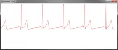 Capteur ECG AD8232 Heart Rate Normal